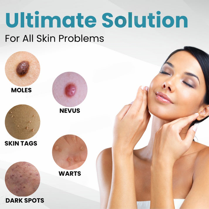 Natravor™ Non-Invasive Mole and Wart Removal Laser Pen