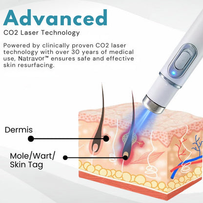 Natravor™ Non-Invasive Mole and Wart Removal Laser Pen
